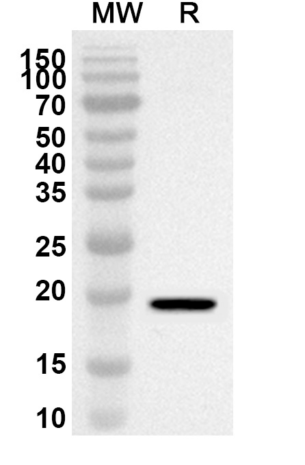 Anti-Human C1QTNF12 Polyclonal Antibody binds to Recombinant Human C1QTNF12, N-His in WB Assay