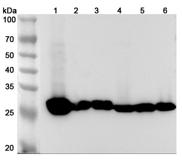 Anti-Human CA3/Carbonic anhydrase 3 Polyclonal Antibody in WB Assay