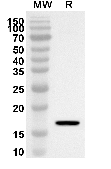 Anti-Human CALCR/Calcitonin receptor/CT-R Polyclonal Antibody binds to Human CALCR/Calcitonin receptor/CT-R Recombinant Protein, C-Fc in WB Assay