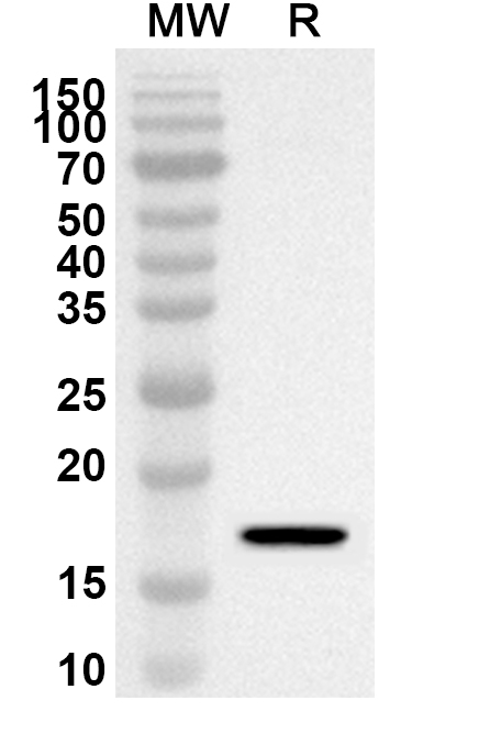 Anti-Human CALD1 Polyclonal Antibody binds to Recombinant Human CALD1 Protein, N-His in WB Assay