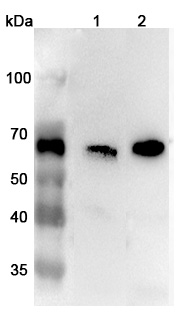 Anti-Human CARM1 Polyclonal Antibody binds to Recombinant Human CARM1 Protein, N-His in WB Assay