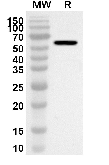 Anti-Human CBS Polyclonal Antibody binds to Recombinant Human CBS Protein, N-His in WB Assay