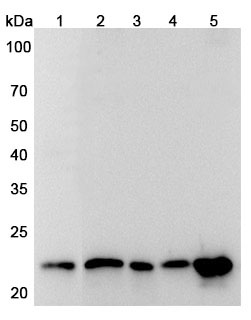 Anti-Human CBX5 Polyclonal Antibody binds to Recombinant Human CBX5 Protein, N-His-SUMO in WB Assay