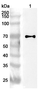 Anti-Human CCDC6 Polyclonal Antibody binds to Human CCDC6 Recombinant Protein, N-GST & C-His in WB Assay