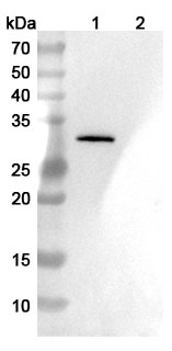 Anti-Human CCL5/RANTES Antibody (SAA0456) binds to CCL5 / RANTES, N-GST, recombinant protein in WB Assay