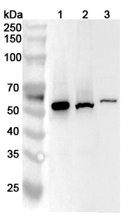 Anti-Human CCNA2 Polyclonal Antibody binds to Human CCNA2 Recombinant Protein, N-His in WB Assay