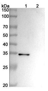 Anti-Human CD156b/ADAM17 (MEDI3622) binds to Recombinant Human CD156b/ADAM17, N-His in WB Assay