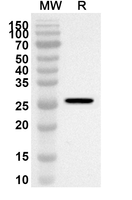 Anti-Human CD5 Polyclonal Antibody binds to Mouse CD5 Recombinant Protein, C-His in WB Assay