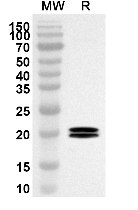 Anti-Human CD88/C5AR1 Polyclonal Antibody binds to Recombinant Human CD88/C5AR1 Protein, N-His-SUMO in WB Assay