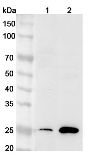 Anti-Human CDCA3 Polyclonal Antibody binds to Recombinant Human CDCA3 Protein, N-His in WB Assay