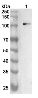 Anti-Human CDH3 Polyclonal Antibody binds to Human CDH3 Recombinant Protein, N-His in WB Assay