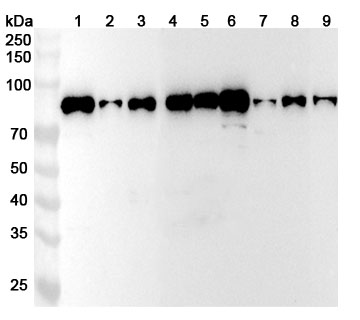 Anti-Human CENPB Polyclonal Antibody binds to Recombinant Human CENPB Protein, N-His in WB Assay
