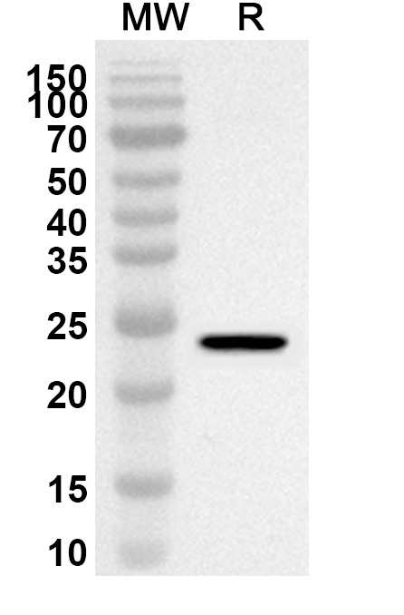 Anti-Human CEP112 Polyclonal Antibody binds to Human CEP112 Recombinant Protein, N-GST & C-His in WB Assay