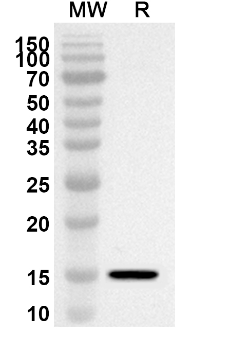 Anti-Human CEP43 Polyclonal Antibody binds to Recombinant Human CEP43 Protein, N-His in WB Assay