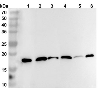 Anti-Human CFL2 Polyclonal Antibody binds to Recombinant Human CFL2 Protein, N-His-SUMO in WB Assay
