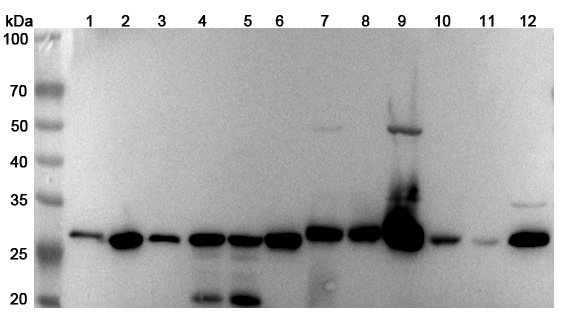 Anti-Human CHCHD3 Polyclonal Antibody binds to Recombinant Human CHCHD3 Protein, N-His in WB Assay