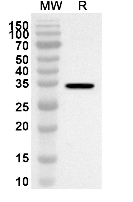 Anti-Human CLDN9 Polyclonal Antibody binds to Recombinant Human CLDN9 Protein, N-GST & C-His in WB Assay