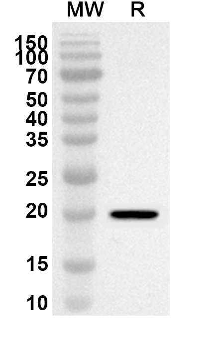 Anti-Human CNBP Polyclonal Antibody binds to Recombinant Human CNBP Protein, N-His-SUMO in WB Assay