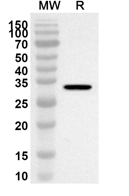 Anti-Human CNOT9 Polyclonal Antibody binds to Recombinant Human CNOT9 Protein, N-His in WB Assay