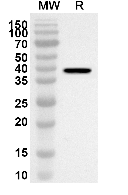 Anti-Human CNR1/CB1 Polyclonal Antibody in WB Assay