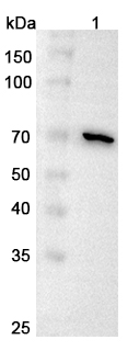 Anti-Human COL8A1 Polyclonal Antibody binds to Recombinant Human COL8A1, N-His in WB Assay