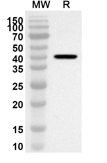 Anti-Human COX5A Polyclonal Antibody binds to Recombinant Human COX5A, N-GST in WB Assay