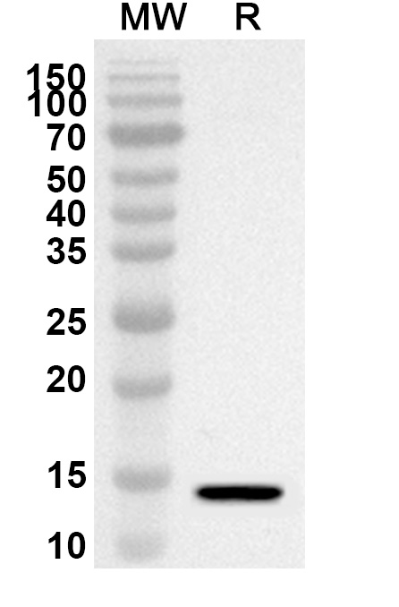 Anti-Human CPSF6 Polyclonal Antibody binds to Recombinant Human CPSF6 Protein, N-His in WB Assay