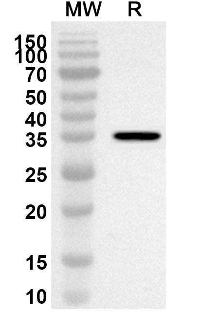 Anti-Human CTPS2 Polyclonal Antibody binds to Recombinant Human CTPS2 Protein, N-His in WB Assay