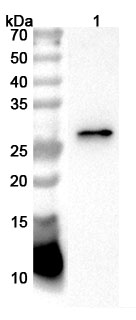 Anti-Human CTRL Polyclonal Antibody binds to Recombinant Human CTRL Protein, N-His in WB Assay