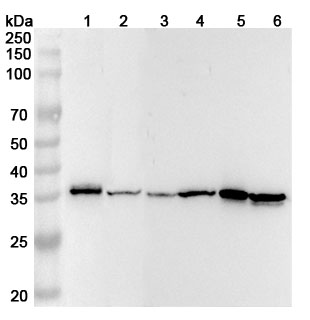 Anti-Human Cyclin D1 Polyclonal Antibody binds to Human Cyclin D1 Recombinant Protein, N-His in WB Assay