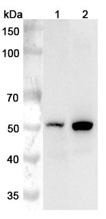 Anti-Human CYP11A1 Polyclonal Antibody binds to Recombinant Human CYP11A1 Protein, N-His in WB Assay