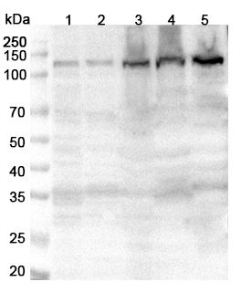 Anti-Human DAAM1 Polyclonal Antibody binds to Recombinant Human DAAM1, N-His in WB Assay