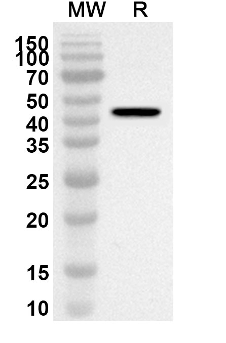 Anti-Human DBP/GC Polyclonal Antibody binds to Mouse DBP Recombinant Protein, N-His in WB Assay