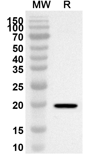 Anti-Human DDHD2 Polyclonal Antibody binds to Recombinant Human DDHD2 Protein, N-His in WB Assay