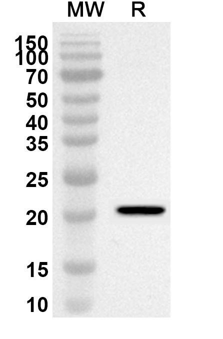 Anti-Human DIRAS1 Polyclonal Antibody binds to Recombinant Human DIRAS1 Protein, N-His in WB Assay