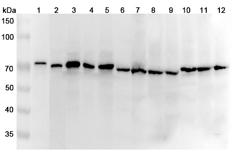 Anti-Human DLAT Polyclonal Antibody binds to Recombinant Human DLAT Protein, N-His in WB Assay