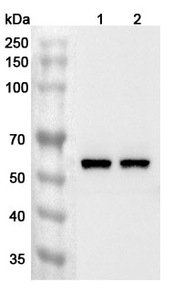 Anti-Human DMAP1 Polyclonal Antibody binds to Recombinant Human DMAP1 Protein, N-His in WB Assay