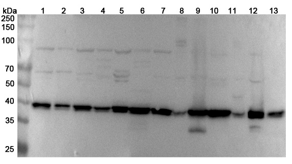 Anti-Human DNAJB11 Polyclonal Antibody binds to Recombinant Human DNAJB11 Protein, N-His in WB Assay