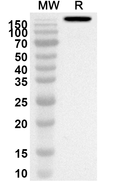 Anti-Human DNASE1L2 Polyclonal Antibody binds to Recombinant Human DNASE1L2 Protein, N-His in WB Assay