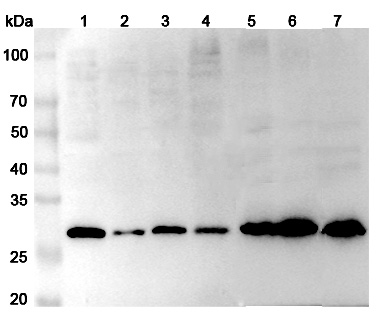 Anti-Human DPT Polyclonal Antibody binds to Recombinant Human DPT Protein, N-His in WB Assay