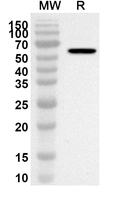 Anti-Human DSG1 Polyclonal Antibody binds to Recombinant Human DSG1, N-His in WB Assay