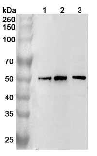 Anti-Human DTNBP1 Polyclonal Antibody binds to Recombinant Human DTNBP1 Protein, N-His in WB Assay