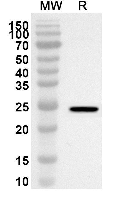 Anti-Human DVL1 Polyclonal Antibody binds to Recombinant Human DVL1 Protein, N-His-SUMO in WB Assay