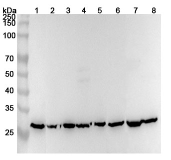Anti-Human ECHS1 Polyclonal Antibody binds to Recombinant Human ECHS1 Protein, N-His in WB Assay