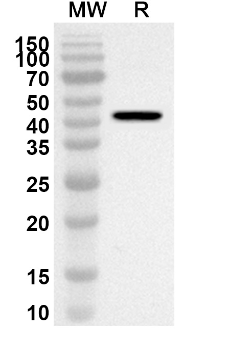 Anti-Human EHD2 Polyclonal Antibody binds to Recombinant Human EHD2 Protein, N-His in WB Assay