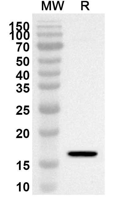 Anti-Human EIF2S2 Polyclonal Antibody binds to Recombinant Human EIF2S2 Protein, N-His in WB Assay