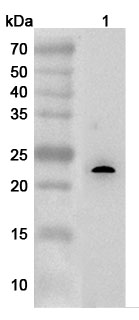 Anti-Human ESM1 Polyclonal Antibody binds to Recombinant Mouse ESM1, N-His in WB Assay