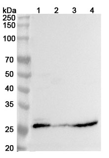 Anti-Human ETHE1 Polyclonal Antibody binds to Recombinant Human ETHE1 Protein, N-His in WB Assay
