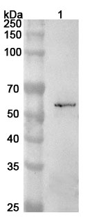 Anti-Human ETS1 Polyclonal Antibody binds to Recombinant Human ETS1 Protein, N-His in WB Assay