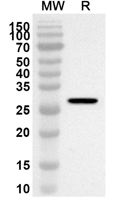 Anti-Human EXOSC8 Polyclonal Antibody binds to Recombinant Human EXOSC8 Protein, N-His in WB Assay